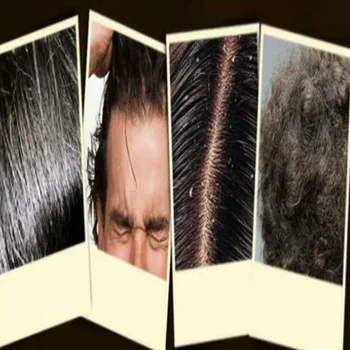 Melna matu šampūns melnās matu šampūnu, sieviešu, vīriešu cietiem matiem pret blaugznām tumši mati cietu matu šampūns MPwell